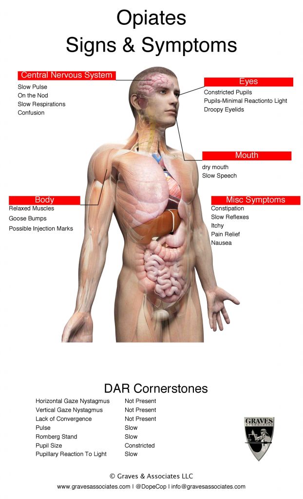 DAR Cornerstones Opiates